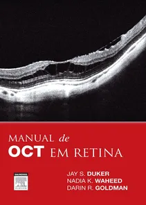 Manual de OCT em Retina