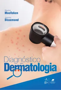 Diagnóstico Em Dermatologia