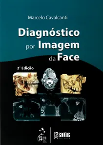 Diagnóstico por Imagem da Face