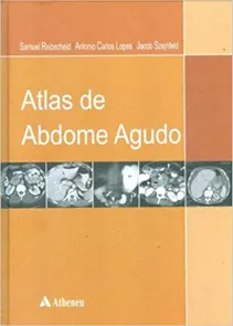 Atlas do Abdome Agudo
