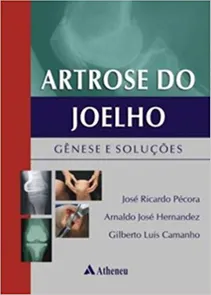 Artrose do Joelho Gênese e Soluções