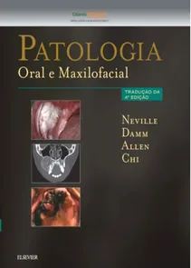 Patologia - Oral e Maxilofacial