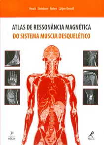 Atlas de Ressonância Magnética do Sistema Musculoesqulético