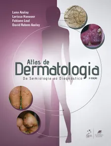 Atlas de Dermatologia - Da Semiologia ao Diagnóstico