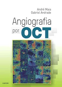 Angiografia Por  OCT