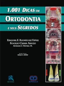 1.001 Dicas Em Ortodontia E Seus Segredos